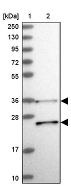 Lane 1: Marker [kDa] 250, 130, 95, 72, 55, 36, 28, 17, 10_br/_Lane 2: Human cell line RT-4