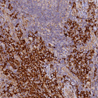 Anti-SSC5D Antibody