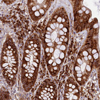 Anti-SSC5D Antibody