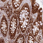 Immunohistochemical staining of human rectum shows strong cytoplasmic positivity in glandular cells.