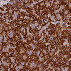 Anti-SSC5D Antibody