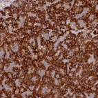 Immunohistochemical staining of human pancreas shows strong cytoplasmic positivity in exocrine glandular cells.