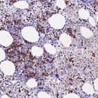 Anti-C16orf96 Antibody