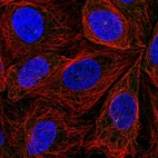 Immunofluorescent staining of human cell line SiHa shows localization to centrosome.