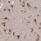 Immunohistochemical staining of human cerebral cortex shows high expression.