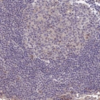 Immunohistochemical staining of human lymph node shows low expression as expected.