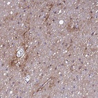 Anti-P2RX7 Antibody