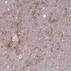 Anti-P2RX7 Antibody