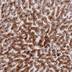 Anti-ADAMTS13 Antibody