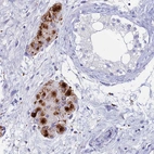 Immunohistochemical staining of human testis shows strong granular cytoplasmic positivity in Leydig cells.