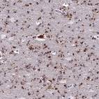 Immunohistochemical staining of human cerebral cortex shows strong cytoplasmic positivity in glial cells.
