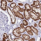 Immunohistochemical staining of human kidney shows strong granular cytoplasmic positivity in cells in tubules.