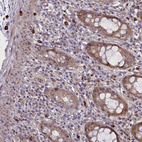 Immunohistochemical staining of human rectum shows moderate cytoplasmic positivity in mast cell.