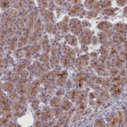 Immunohistochemical staining of human pancreas shows moderate cytoplasmic positivity in exocrine glandular cells.