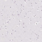 Immunohistochemical staining of human cerebral cortex shows low expression as expected.