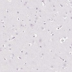 Anti-EHHADH Antibody