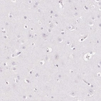 Immunohistochemical staining of human cerebral cortex shows low expression as expected.
