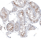 Anti-KNSTRN Antibody