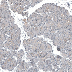 Anti-KNSTRN Antibody