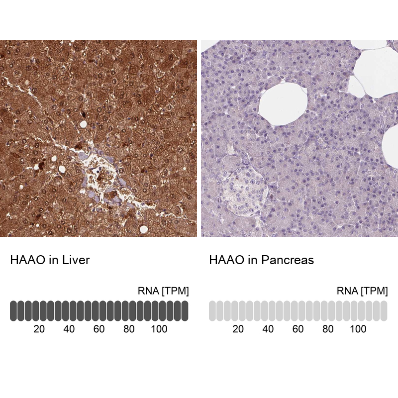 Anti-HAAO Antibody