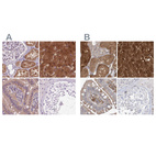 Immunohistochemical staining of human kidney, liver, small intestine and testis using Anti-HAAO antibody HPA042024 (A) shows similar protein distribution across tissues to independent antibody HPA036394 (B).