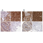 Immunohistochemical staining of human kidney, liver, small intestine and testis using Anti-HAAO antibody HPA042024 (A) shows similar protein distribution across tissues to independent antibody HPA036394 (B).