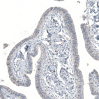 Anti-KNSTRN Antibody