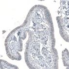 Immunohistochemical staining of human Fallopian tube shows no positivity in glandular cells as expected.