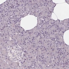 Immunohistochemical staining of human pancreas shows low expression as expected.