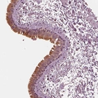 Immunohistochemical staining of human bronchus shows strong positivity in ciliated cells.