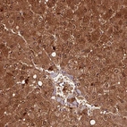 Immunohistochemical staining of human liver shows high expression.