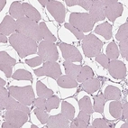 Immunohistochemical staining of human skeletal muscle shows no cytoplasmic positivity in myocytes as expected.
