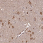 Anti-STX16 Antibody