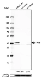 Western blot analysis in U-138MG cells transfected with control siRNA, target specific siRNA probe #1 and #2, using Anti-STX16 antibody. Remaining relative intensity is presented. Loading control: Anti-GAPDH.