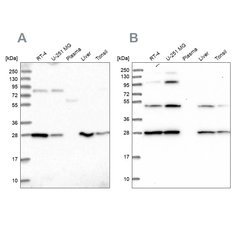 Rabbit Polyclonal Anti-PGLS Antibody - Buy for research - Highly ...