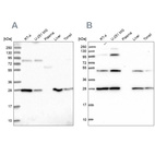 Western blot analysis using Anti-PGLS antibody HPA042032 (A) shows similar pattern to independent antibody HPA040744 (B).