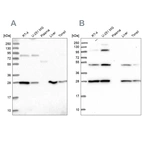 Western blot analysis using Anti-PGLS antibody HPA042032 (A) shows similar pattern to independent antibody HPA040744 (B).