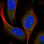 Immunofluorescent staining of human cell line U-2 OS shows localization to vesicles.