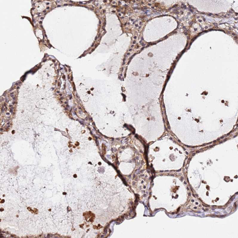 Anti-KATNAL2 Antibody