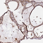 Anti-KATNAL2 Antibody