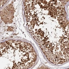 Immunohistochemical staining of human testis shows strong cytoplasmic and membranous positivity in cells in seminiferous ducts.