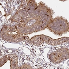 Immunohistochemical staining of human fallopian tube shows moderate cytoplasmic positivity in glandular cells.