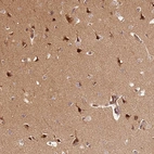 Immunohistochemical staining of human cerebral cortex shows strong cytoplasmic positivity in neurons.