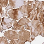 Immunohistochemical staining of human skeletal muscle shows moderate cytoplasmic positivity in myocytes.