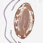 Immunohistochemical staining of human eye using Anti-BFSP1 antibody HPA042038.