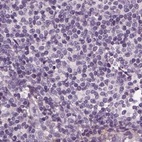 Anti-BFSP1 Antibody
