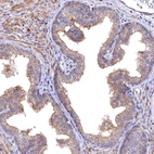 Immunohistochemical staining of human prostate shows moderate membranous positivity in glandular cells.
