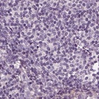 Immunohistochemical staining of human lymph node using Anti-BFSP1 antibody HPA042038.