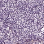 Immunohistochemical staining of human lymph node using Anti-BFSP1 antibody HPA042038.