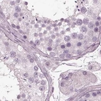 Immunohistochemical staining of human testis using Anti-BFSP1 antibody HPA042038.